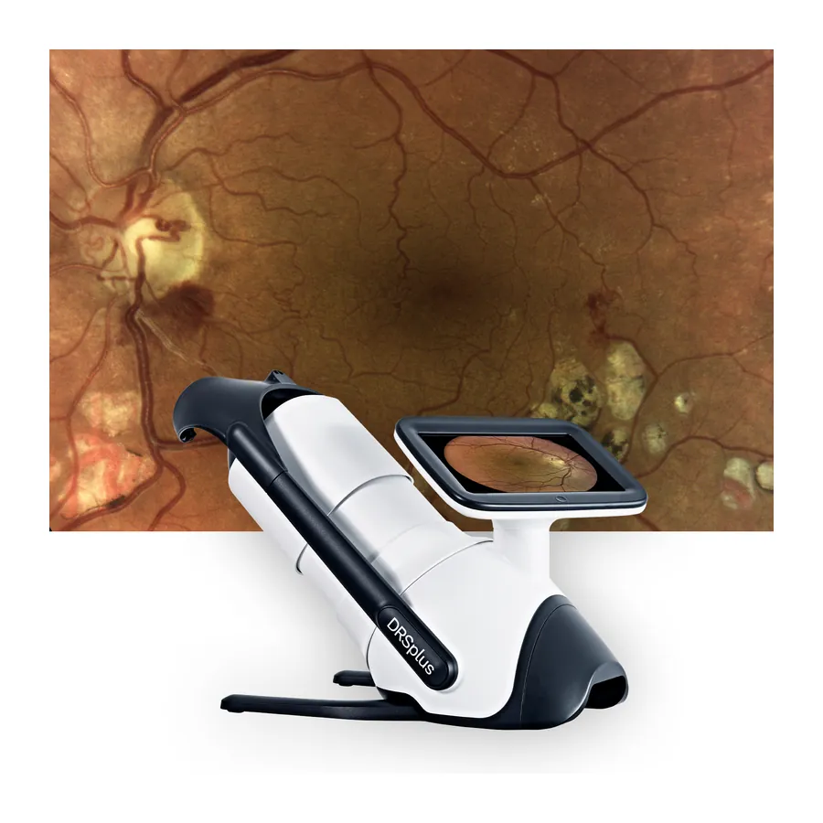 iCare DRSplus Fundus Camera